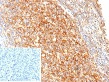 CD21 Antibody