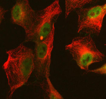 Immunofluorescent staining of FFPE human A549 cells with ABI2 antibody (green) and Alpha Tubulin mAb