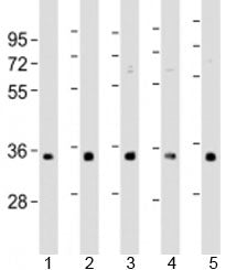 Western blot testing of human 1) A431, 2) HeLa, 3) HepG2, 4) Jurkat and 5) U-2OS cell lysate with RN