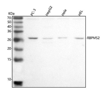 Western blot analysis of RBPMS2 using anti-RBPMS2 antibody. Lane 1: human PC-3 whole cell lysates, L