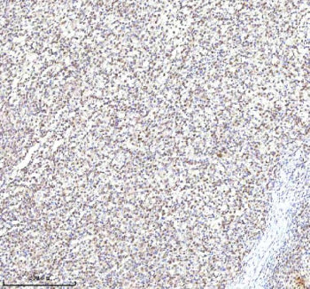 Immunohistochemical staining of RLIM using anti-RLIM antibody. RLIM was detected in a paraffin-embed
