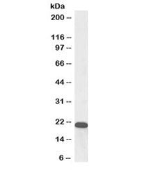 Western blot testing of human kidney lysate with biotinylated UXT antibody at 0.3ug/ml. Predicted mo