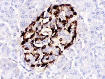 VIP Antibody / PHM-27