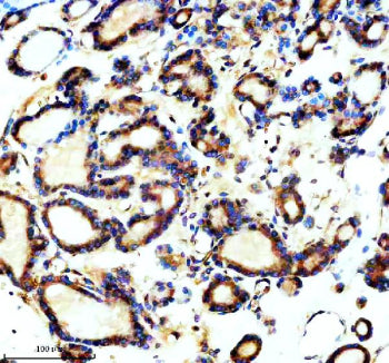 Immunohistochemical staining of TCTN1 using anti-TCTN1 antibody. TCTN1 was detected in a paraffin-em