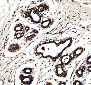 Immunohistochemical staining of RALGAPB using anti-RALGAPB antibody. RALGAPB was detected in a paraf