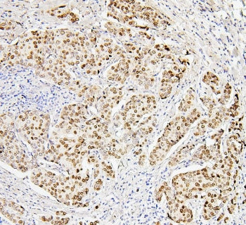 Histone H1.0 Antibody / H1F0