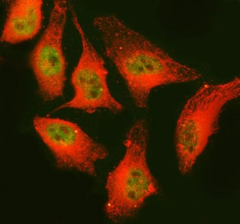 Immunofluorescent staining of FFPE human A549 cells with PAPSS2 antibody (green) and Alpha Tubulin m