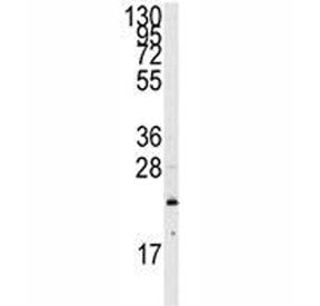 NRAS Antibody