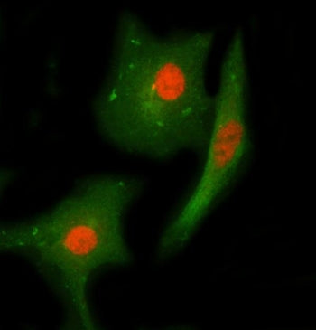 Chk2 Antibody / CHEK2