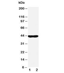 NDRG1 Antibody
