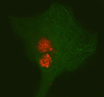 Immunofluorescent staining of PAX3 using anti-PAX3 antibody (red) and anti-Beta Tubulin antibody (gr