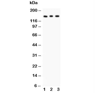 Insulin Receptor Antibody