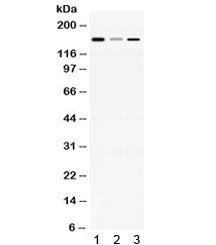 Western blot testing of 1) rat brain, 2) mouse liver and 3) human HepG2 lysate with ADAMTS13 antibod