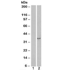 Western blot testing of HEK293 cell lysate overexpressing DOK5 with DOK5 antibody [mock transfection
