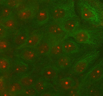 IF analysis of RAD51D using anti-RAD51D antibody (red) and anti-Beta Tubulin antibody (green). RAD51