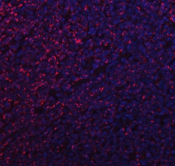Immunofluorescent staining of FFPE human lymphoma tissue with Mitochondrial fission factor antibody