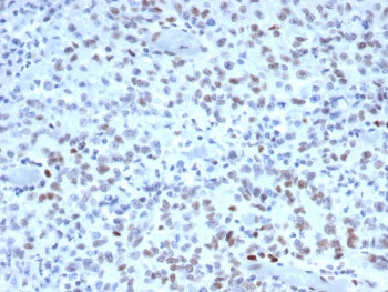 MSH2 Antibody