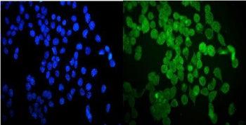 Immunofluorescent staining of FFPE human A431 cells with HSP20 antibody (green) and DAPI nuclear sta