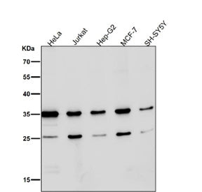 Western blot testing of human samples using the Phospho-Nucleophosmin (Ser125) antibody at 1:3000 di