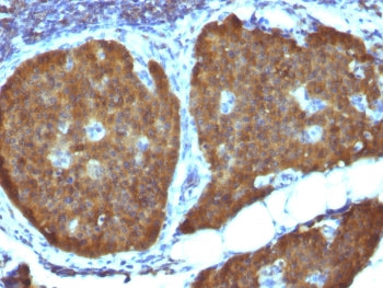 NSE Antibody / Neuron Specific Enolase