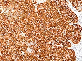 Melanoma Cell Marker Antibody Cocktail (anti-MART-1 + gp100 + Tyrosinase)