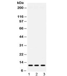 Western blot testing of 1) rat spleen, 2) mouse liver and 3) human HeLa lysate with MPS1 antibody at