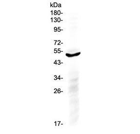 IL6R Antibody (C-Terminal Region)