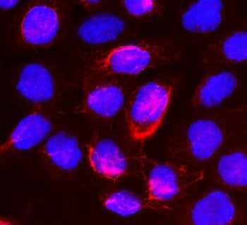Beta Glucuronidase Antibody / Gusb