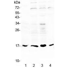 IL-17B / IL-20 Antibody