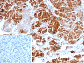 IHC staining of FFPE human adrenal gland tissue with IL22RA2 antibody (clone IL22RA2/7291). Inset: P