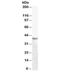 Western blot testing of human liver lysate with Alcohol dehydrogenase antibody at 1ug/ml. Predicted