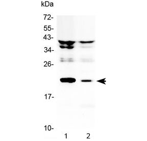 Western blot testing of 1) rat liver and 2) rat kidney lysate with Il11 antibody at 0.5ug/ml. Predic