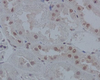 IHC staining of FFPE rat kidney tissue with IRF1 antibody. HIER: boil tissue sections in pH6, 10mM c