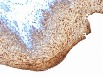 IHC analysis of formalin-fixed, paraffin-embedded human tonsil stained with Cytokeratin 10/13 antibo