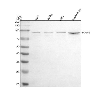 Western blot analysis of PDE4B using anti-PDE4B antibody. Electrophoresis was performed on a 10% SDS