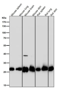 All lanes use the SDHB antibody at 1:3000 dilution for 1 hour at room temperature. Expected molecula