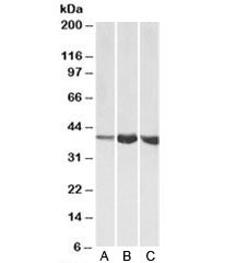 Western blot testing of A) human, B) mouse and C) rat skeletal muscle lysates with Aldolase A antibo