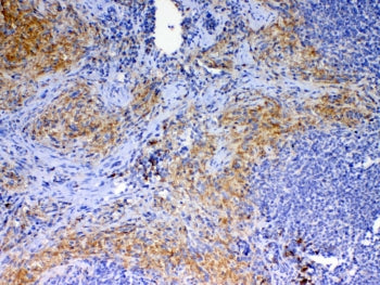 Cd40l Antibody / Trap / Cd154
