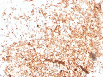 IHC staining of FFPE human tonsil with recombinant IgM antibody (clone rIGHM/3802). HIER: boil tissu