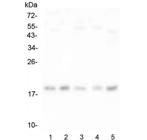 Interferon gamma Antibody / IFNG