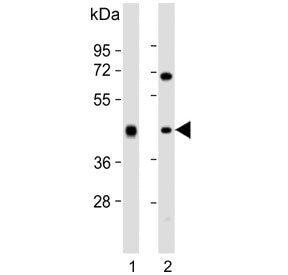 Western blot testing of human 1) liver and 2) Jurkat cell lysate with ADH1B antibody. Predicted mole