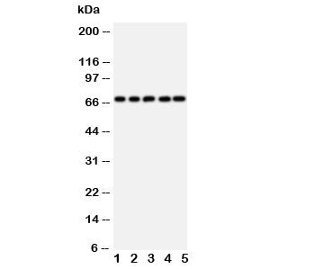 Western blot testing of SHP2 antibody and rat samples 1: heart; 2: skeletal muscle; 3: brain; and hu