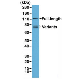 Western blot testing of human 22RV1 cell lysate with recombinant Androgen Receptor antibody. Full le
