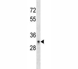 CD40 antibody western blot analysis in HL-60 lysate. Predicted molecular weight is 30-45 kDa dependi