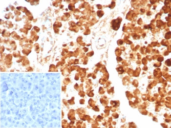 IHC staining of FFPE human pancreas tissue with CPA1 antibody (clone CPA1/8624R). Inset: PBS used in