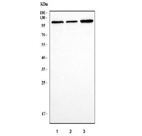 Western blot testing of 1) human HEL, 2) human RT4 and 3) human U-251 cell lysate with PPP1R15A anti
