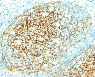 IHC analysis of formalin-fixed, paraffin-embedded human tonsil stained with VCAM-1 antibody (clone 1