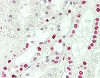 IHC testing of FFPE human kidney tissue with Sm-D3 antibody. HIER: steam section in pH6 citrate buff