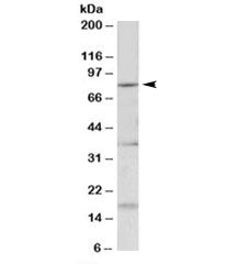 Western blot testing of mouse fetal brain lysate with Kcnc3 antibody at 0.2ug/ml. Predicted molecula