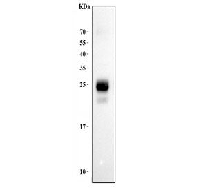 HLA-DPB1 Antibody (MHC II)